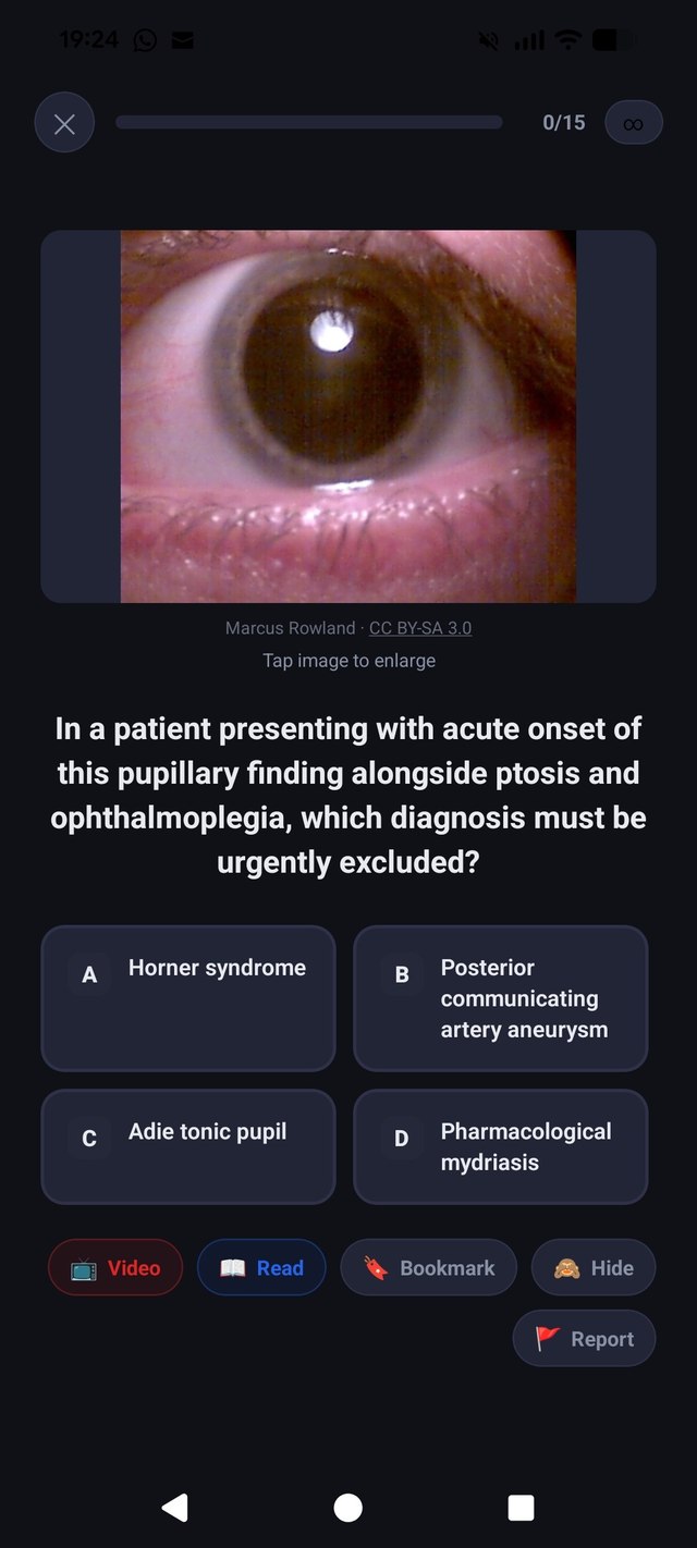 A clinical image question asking the user to identify a diagnosis from an eye photo